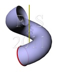 Cyclical helical surface (a circle in a plane orthogonal to helix tangent).